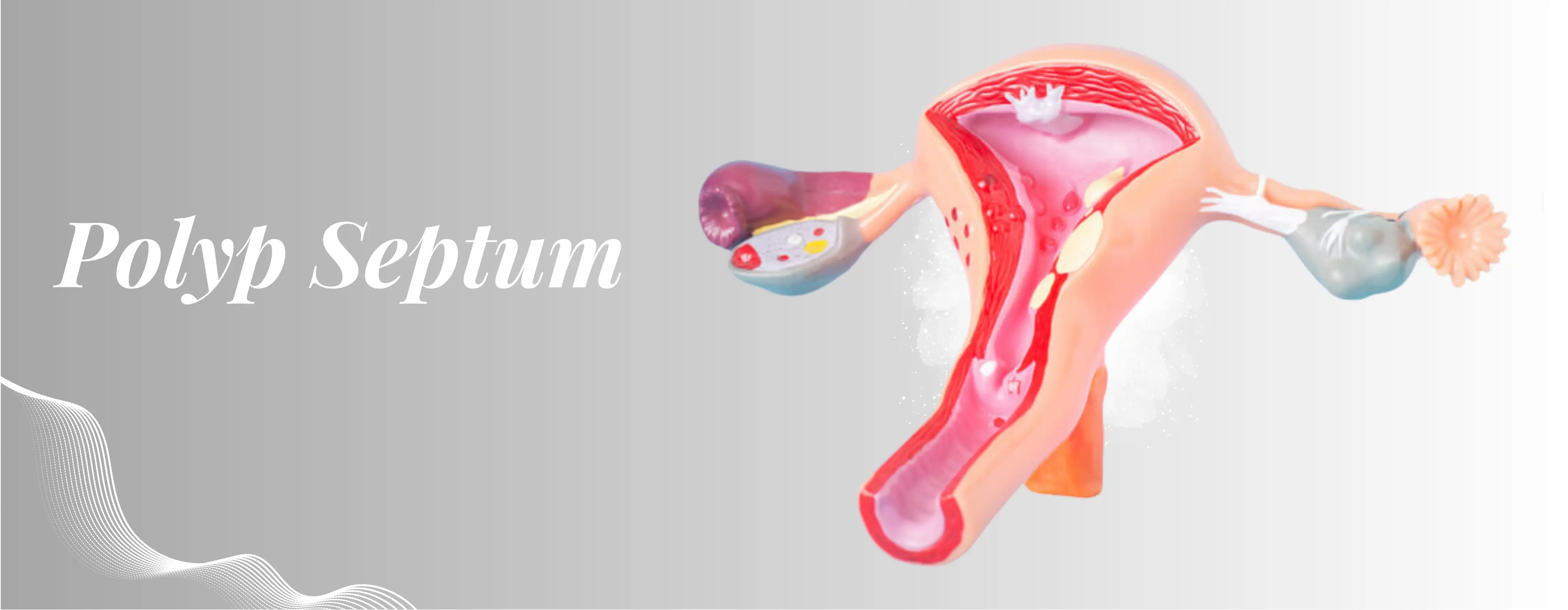 Polyps Septum Surgery In Delhi | Sehgal Nursing Home