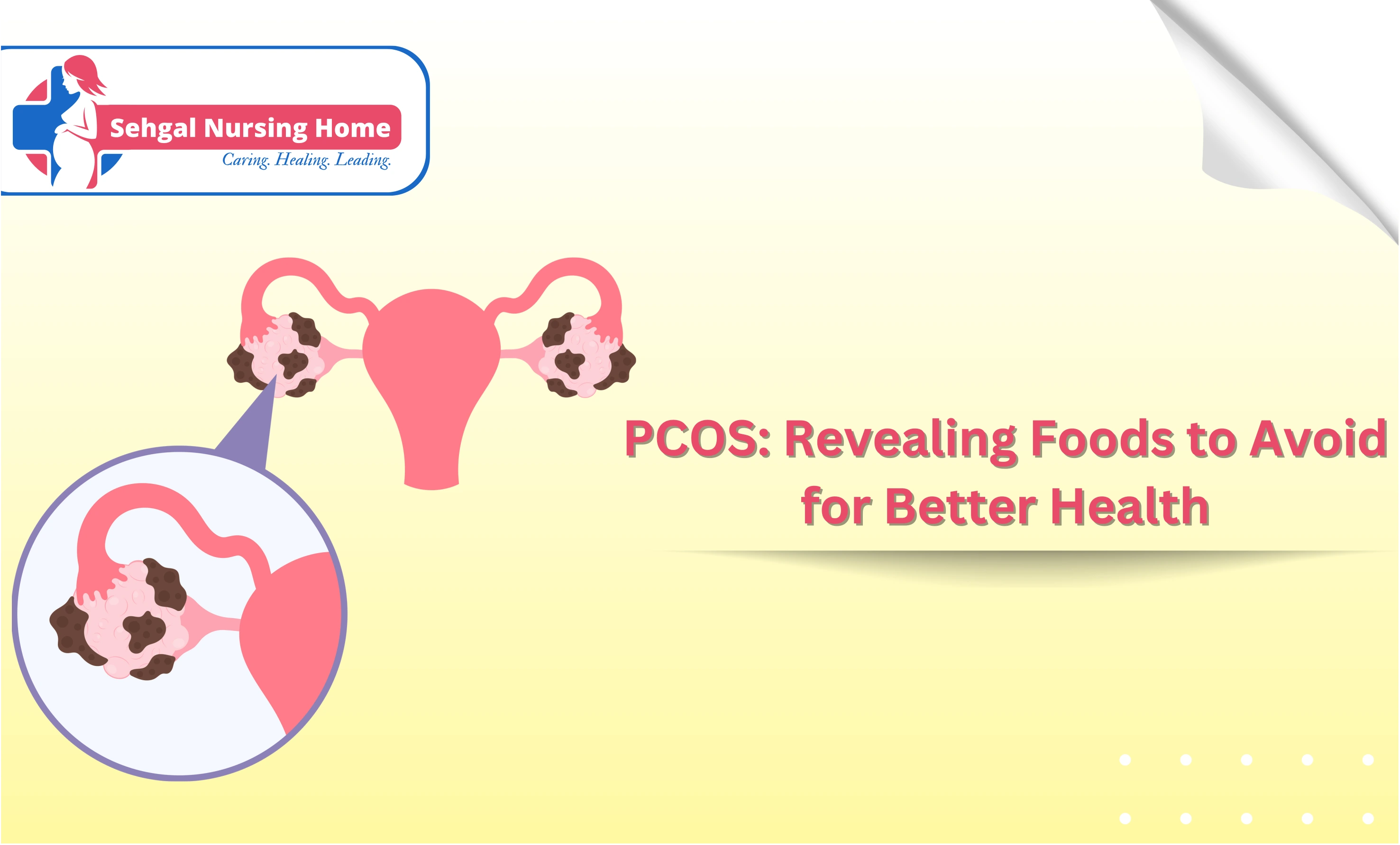PCOS: Revealing Foods To Avoid For Better Health
