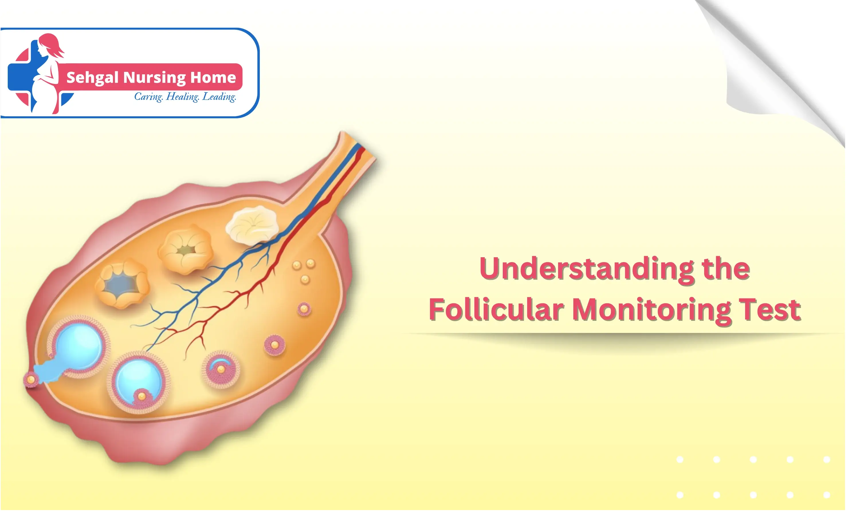 Understanding The Follicular Monitoring Test | Sehgal Nursing Home