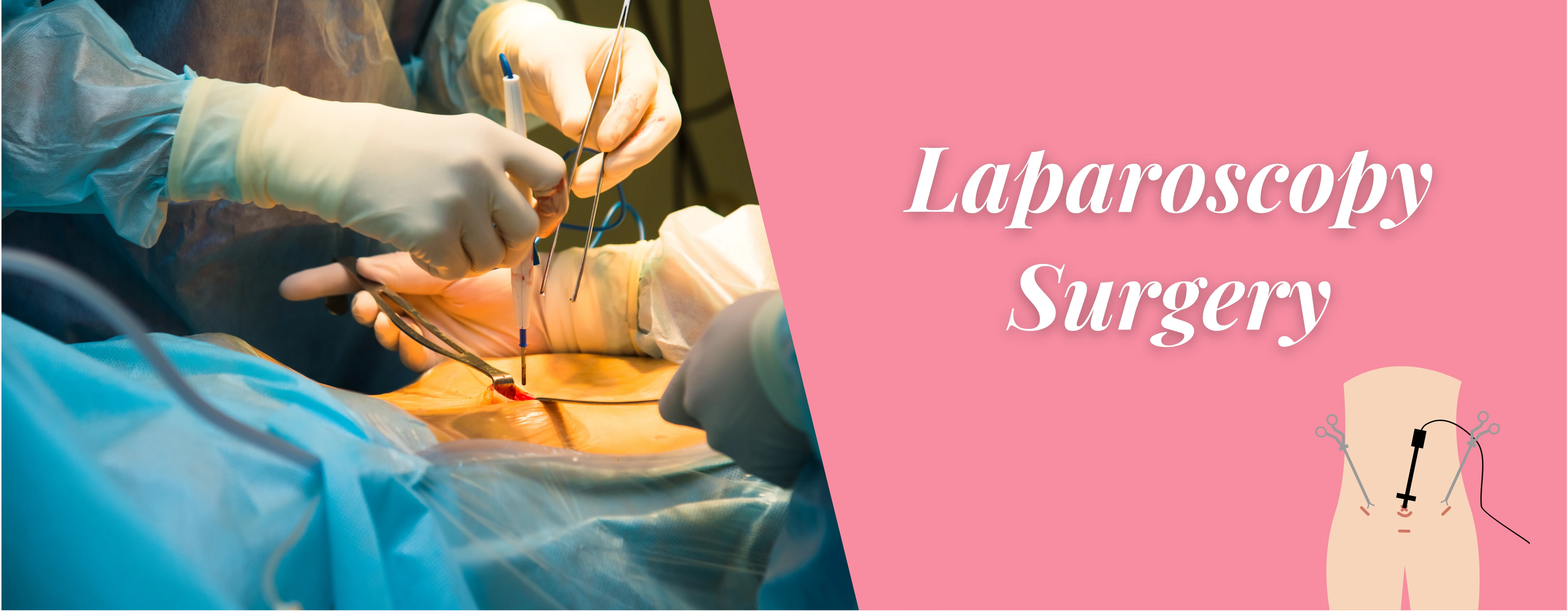 Best Laparoscopic Surgeons In Delhi | Sehgal Nursing Home