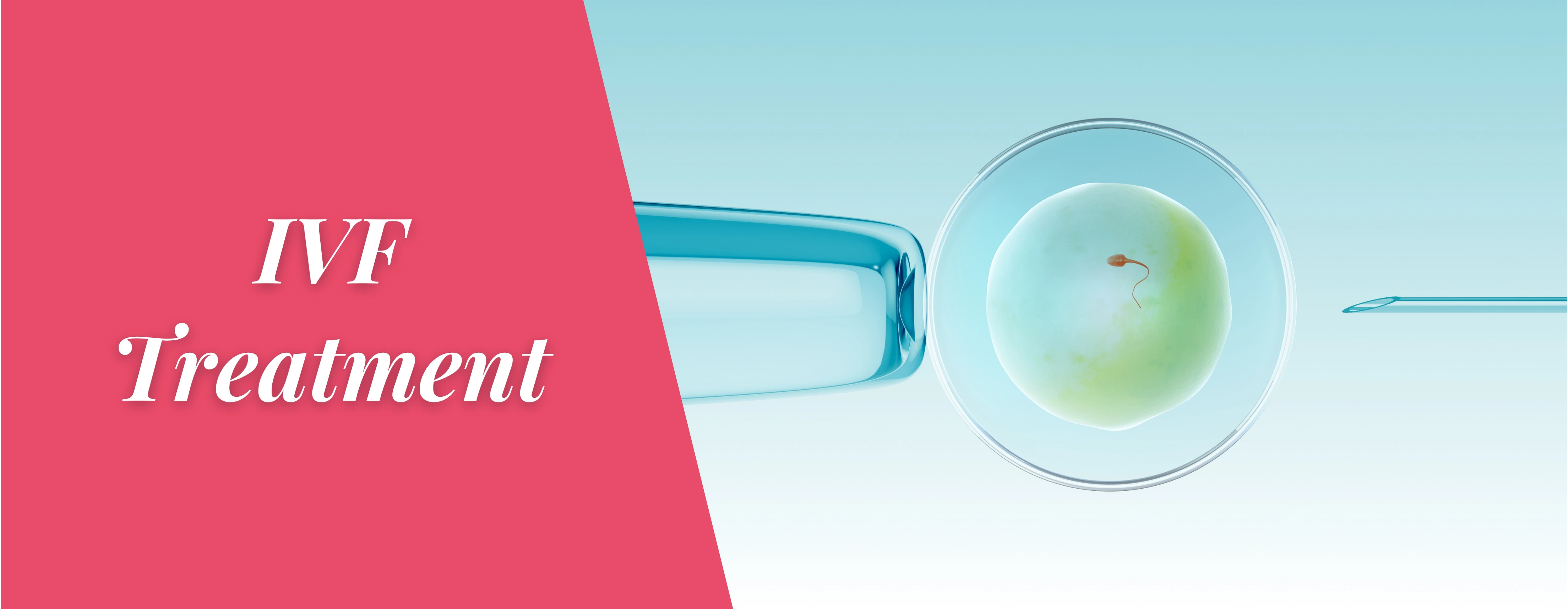 Best IVF Centre In Rohini - Sehgal Nursing Home