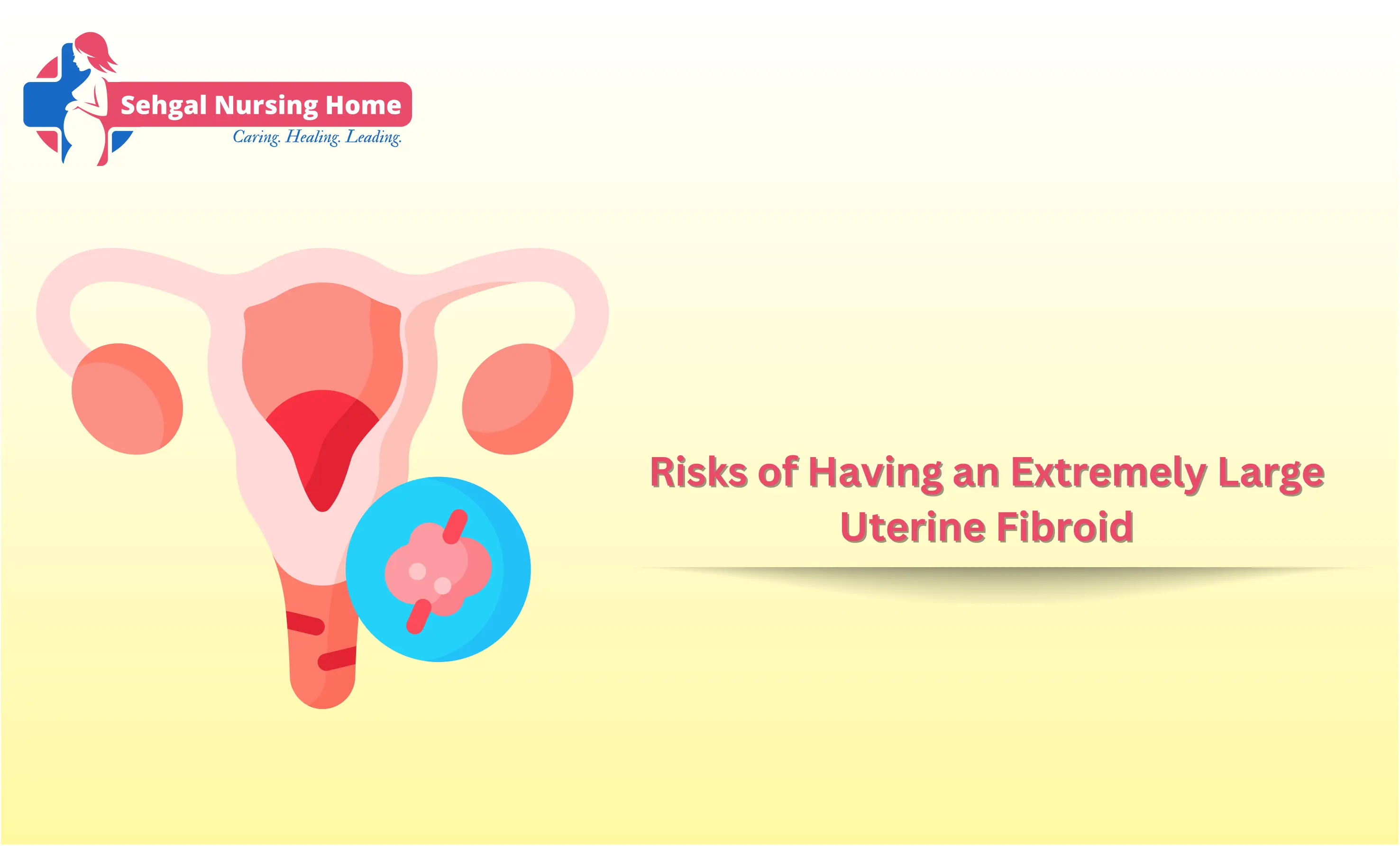 Risks Of Having An Extremely Large Uterine Fibroid