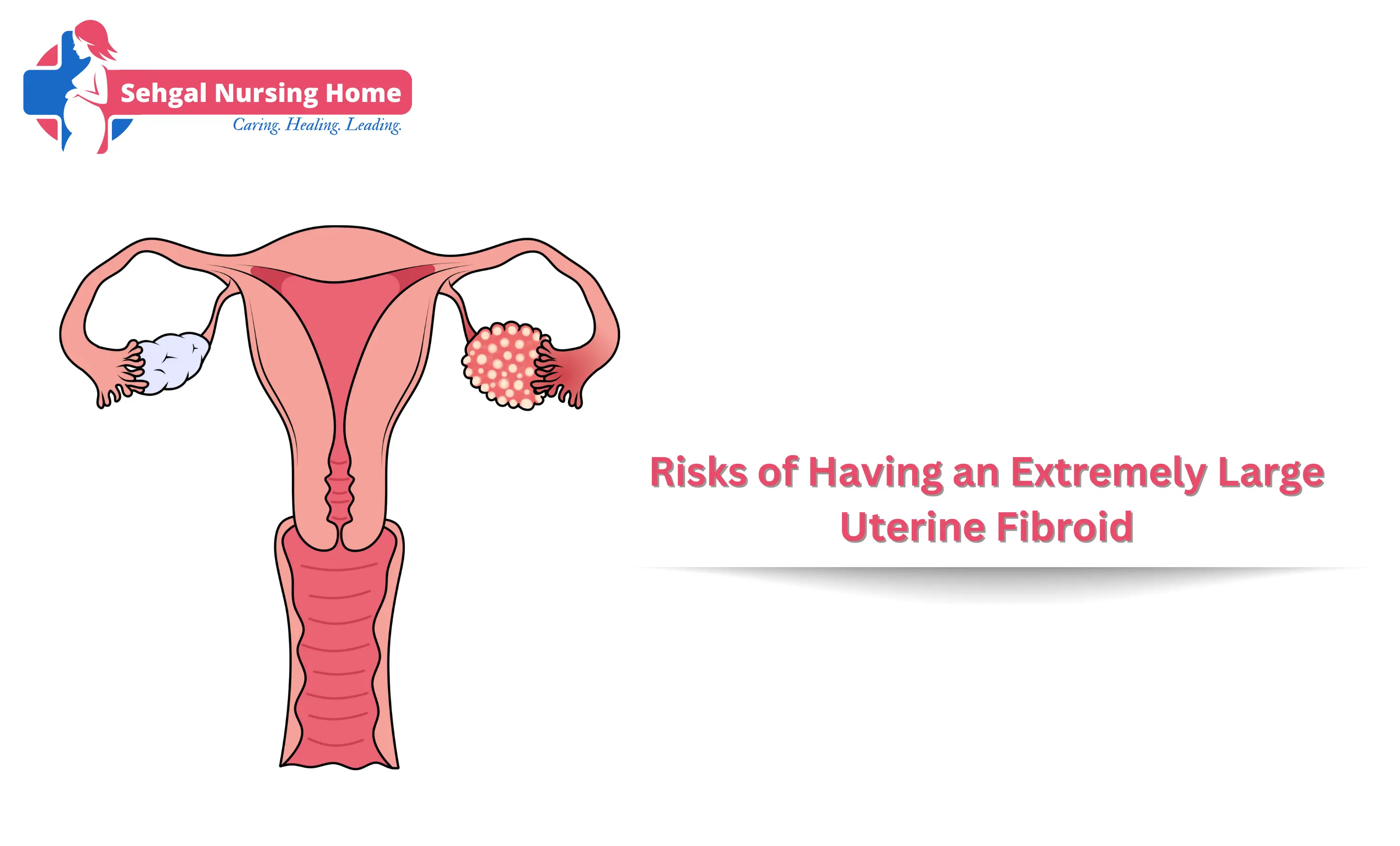 Ovarian Cysts Explained: Symptoms, Diagnosis, & Treatment