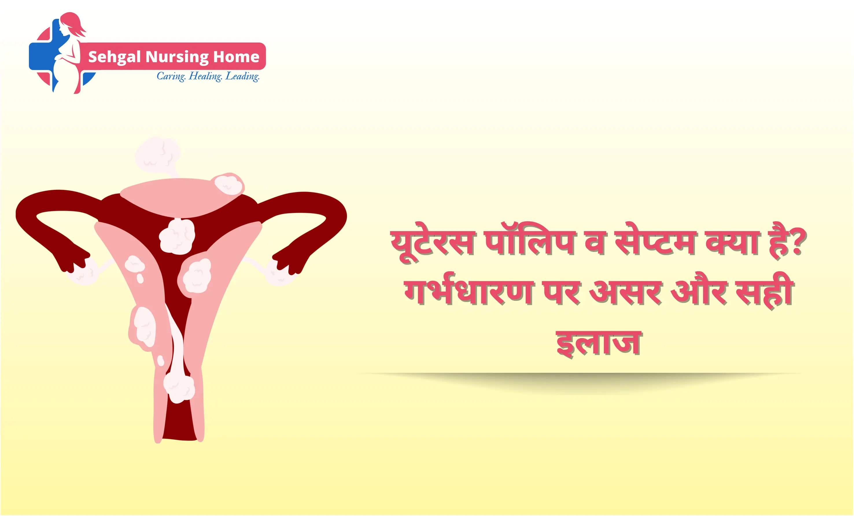 यूटेरस पॉलिप व सेप्टम क्या है? गर्भधारण पर असर और सही इलाज