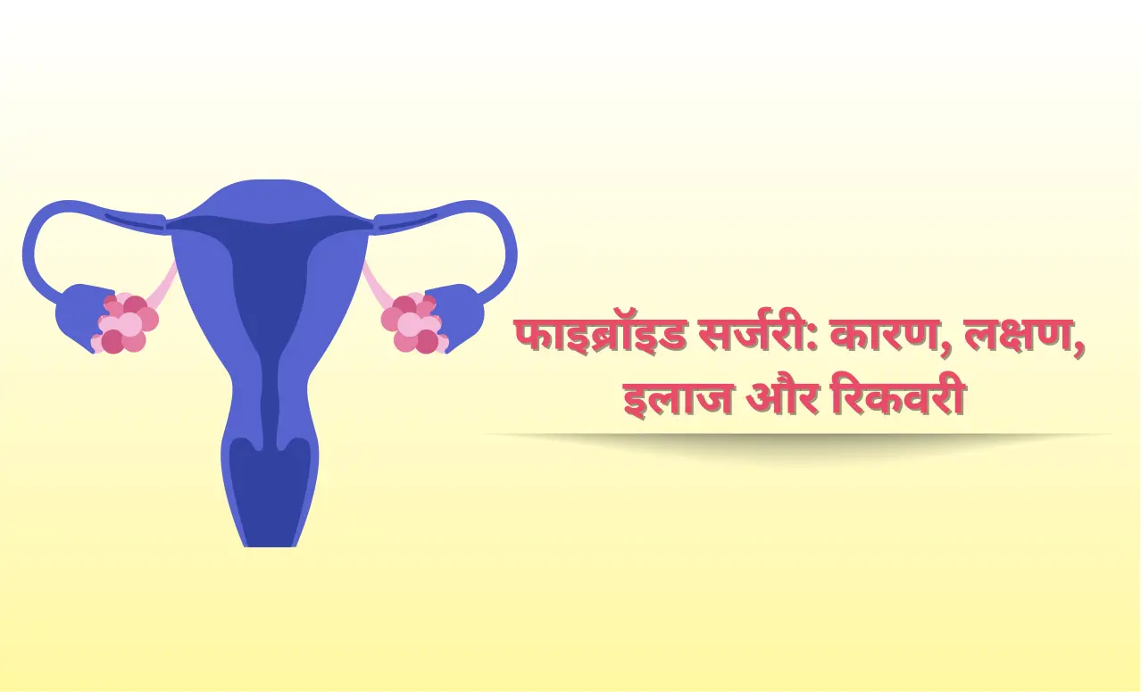 फाइब्रॉइड सर्जरी: कारण, लक्षण, इलाज और रिकवरी 