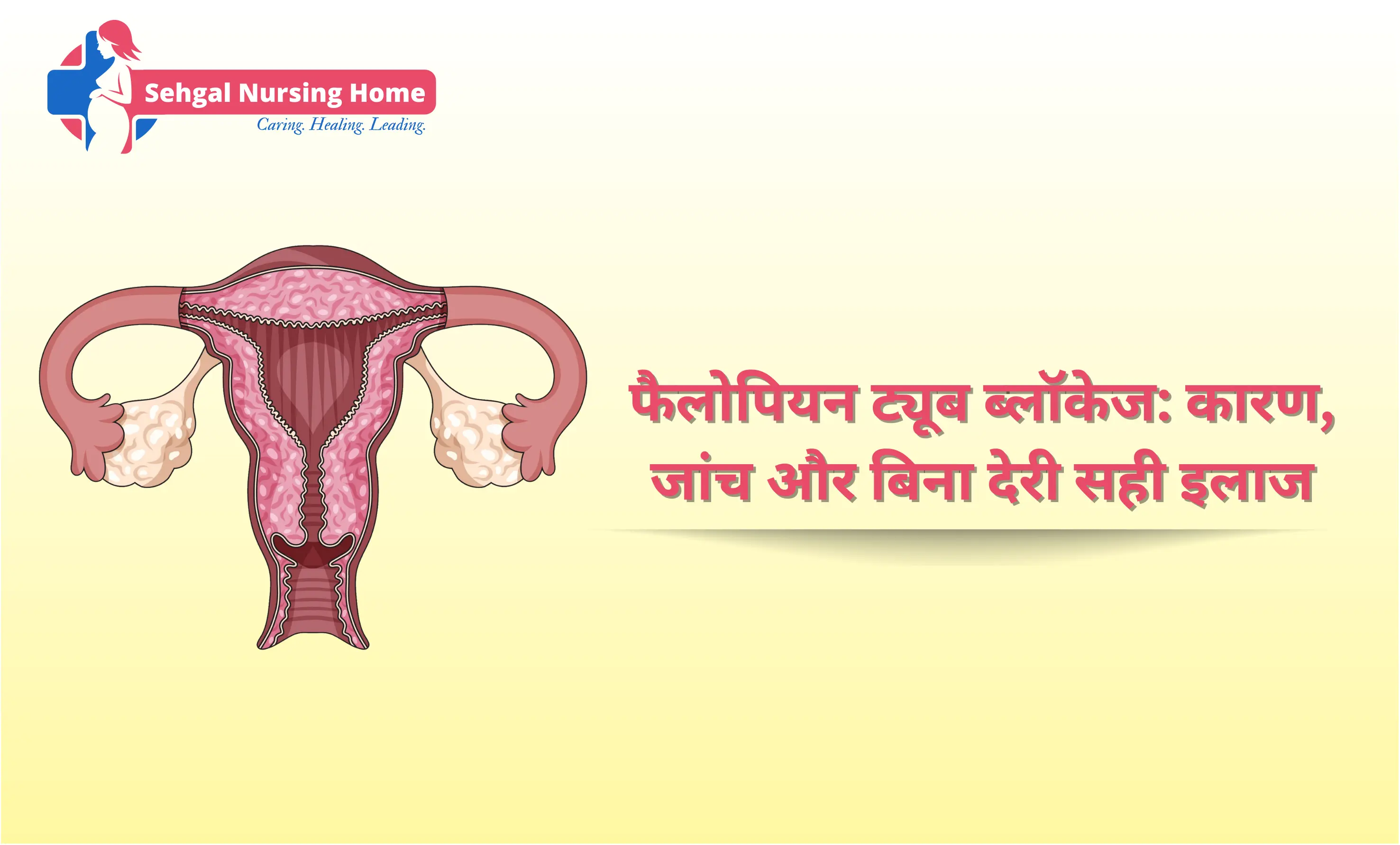 फैलोपियन ट्यूब ब्लॉकेज: कारण, जांच और बिना देरी सही इलाज