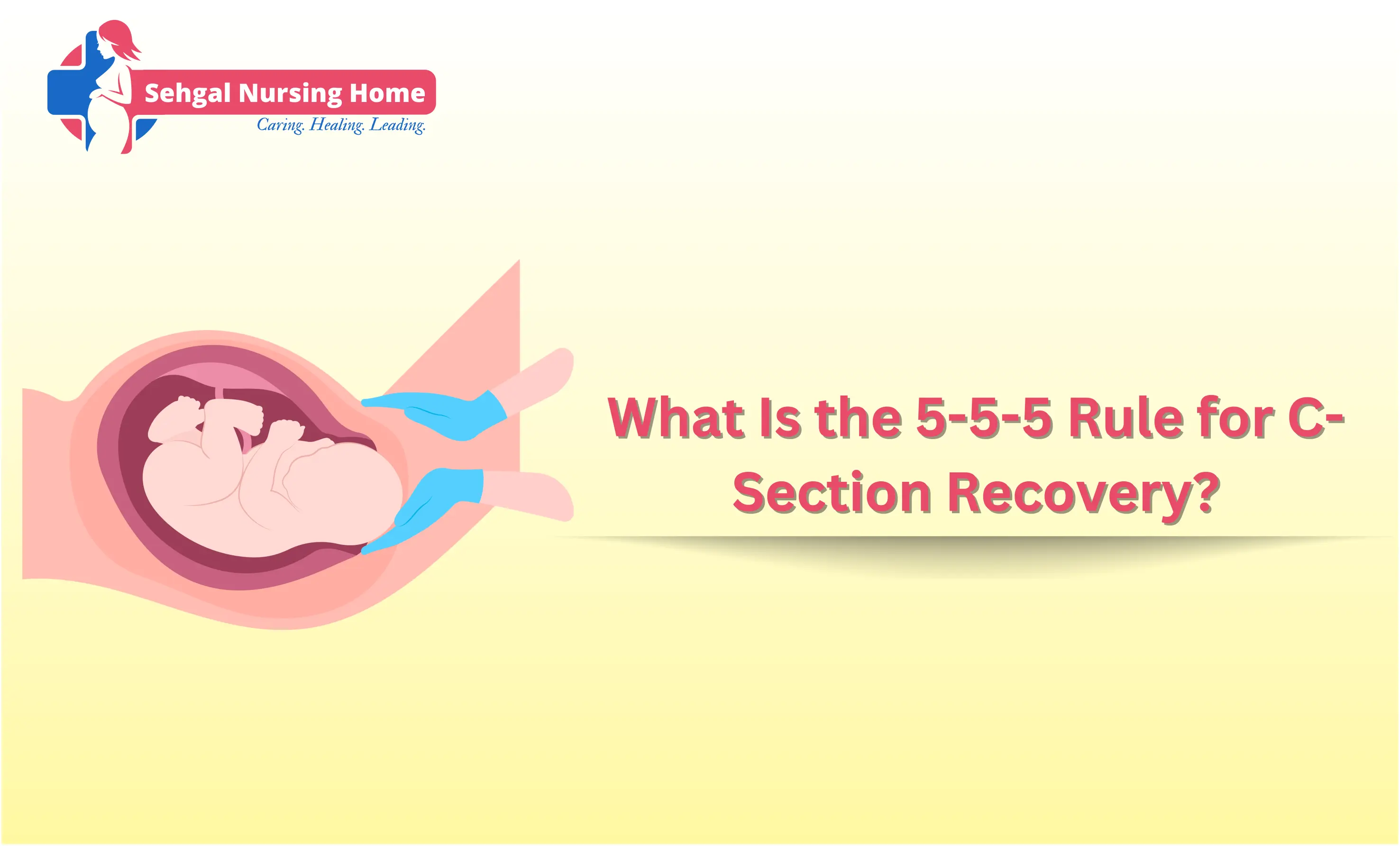 5-5-5 Rule Guide For Smooth C-Section Healing