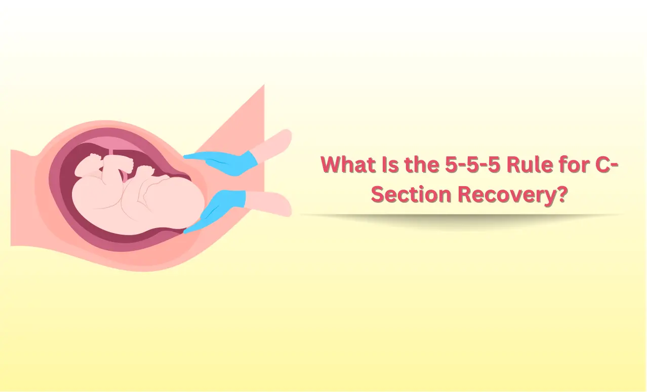 5-5-5 Rule Guide for Smooth C-Section Healing