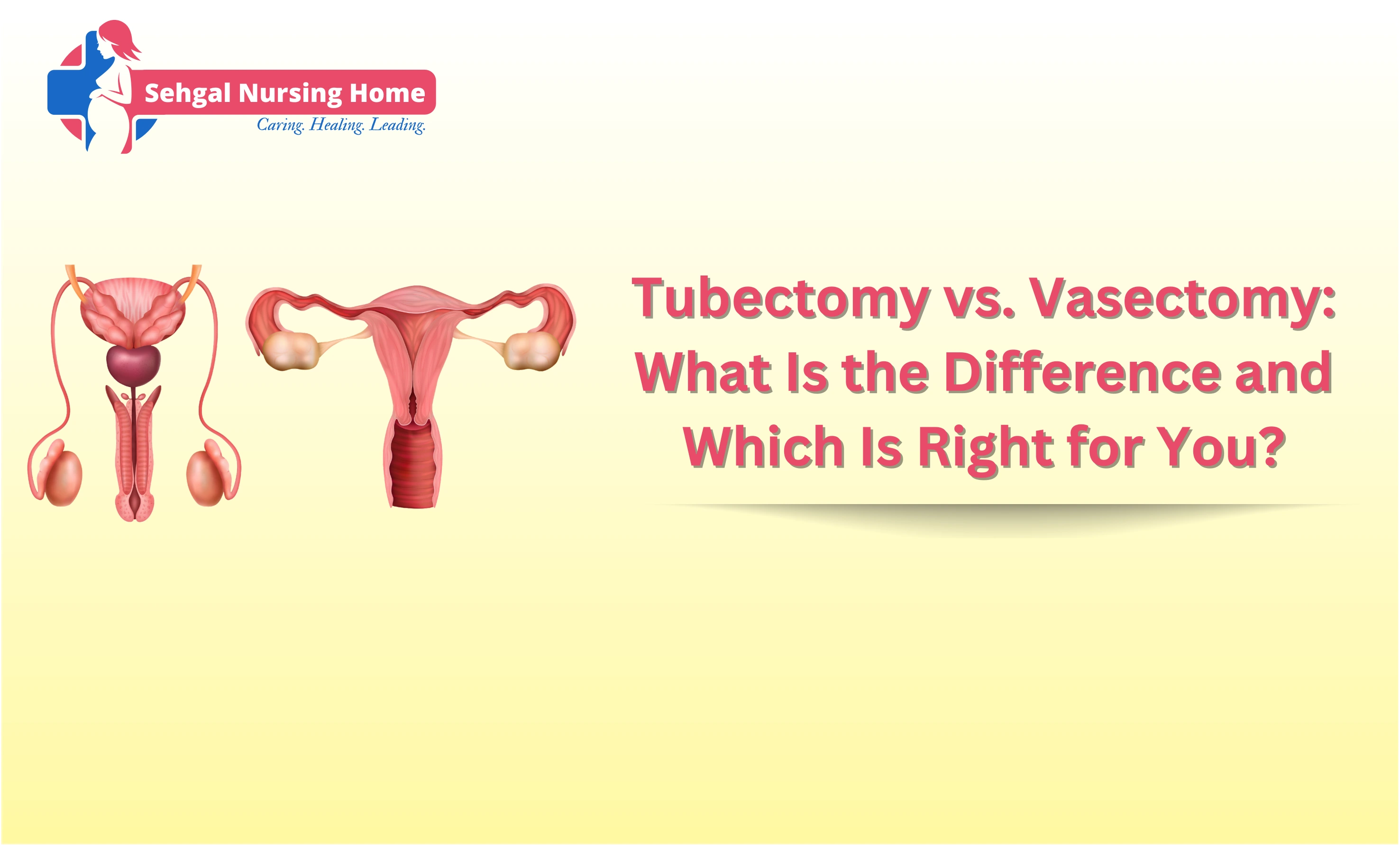 Tubectomy vs Vasectomy: Key Differences Explained