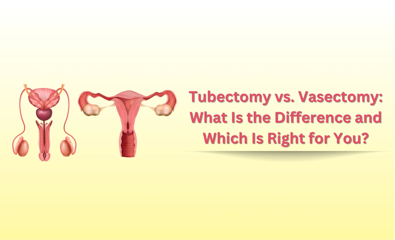 Tubectomy vs Vasectomy: Key Differences Explained